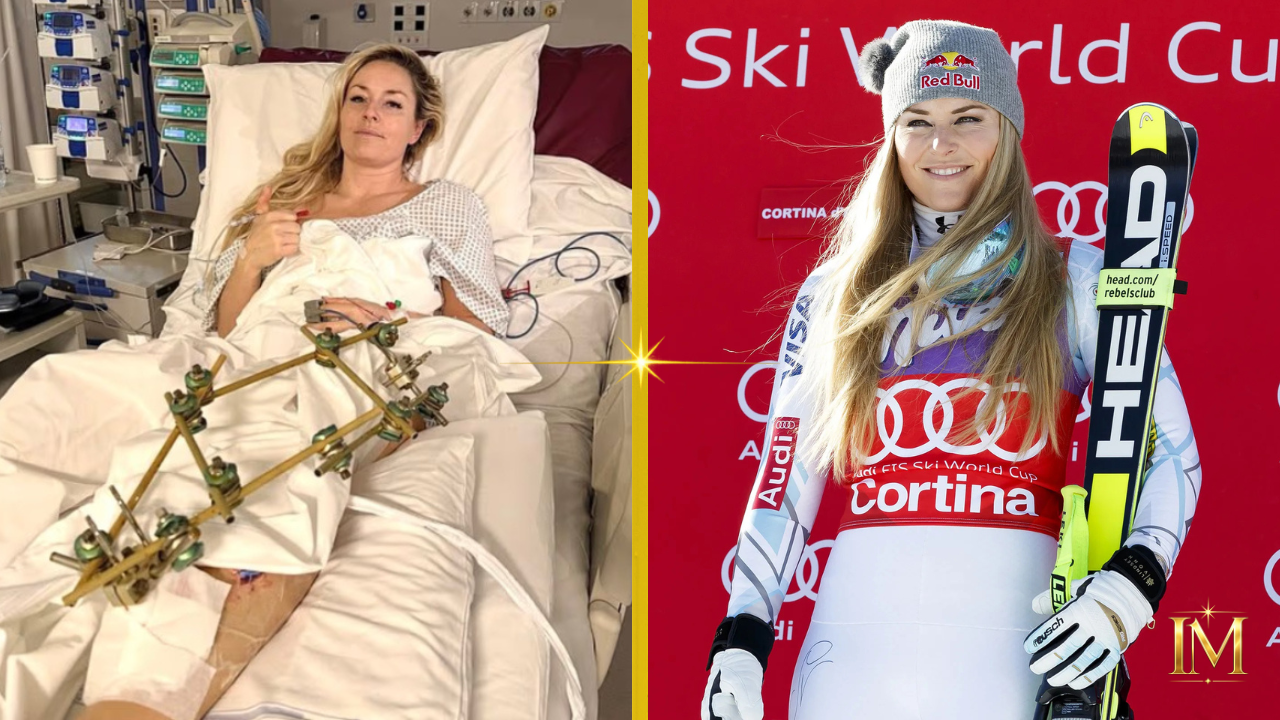 Lindsey Vonn Injury